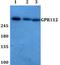 Adhesion G Protein-Coupled Receptor G4 antibody, A13271, Boster Biological Technology, Western Blot image 