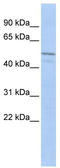 Zinc Finger Imprinted 3 antibody, TA341438, Origene, Western Blot image 