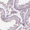 HtrA Serine Peptidase 1 antibody, HPA036655, Atlas Antibodies, Immunohistochemistry paraffin image 