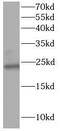 NPC Intracellular Cholesterol Transporter 2 antibody, FNab10049, FineTest, Western Blot image 