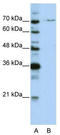 Pre-MRNA Processing Factor 3 antibody, TA345894, Origene, Western Blot image 