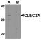 C-Type Lectin Domain Family 2 Member A antibody, A11588, Boster Biological Technology, Western Blot image 