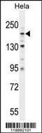 Collagen Type IV Alpha 2 Chain antibody, 55-856, ProSci, Western Blot image 