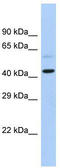 Monocarboxylate transporter 2 antibody, TA334064, Origene, Western Blot image 