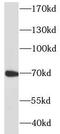 Perforin 1 antibody, FNab06314, FineTest, Western Blot image 