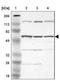 FGR Proto-Oncogene, Src Family Tyrosine Kinase antibody, NBP1-85677, Novus Biologicals, Western Blot image 