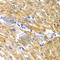 Huntingtin Interacting Protein 1 antibody, A6921, ABclonal Technology, Immunohistochemistry paraffin image 