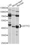 Left-Right Determination Factor 2 antibody, LS-C749079, Lifespan Biosciences, Western Blot image 