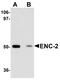 Kelch Like Family Member 25 antibody, NBP1-77147, Novus Biologicals, Western Blot image 