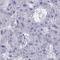 Zinc Finger Protein 561 antibody, HPA055332, Atlas Antibodies, Immunohistochemistry frozen image 