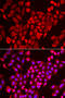 Transition Protein 2 antibody, abx005195, Abbexa, Western Blot image 