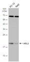 ADP Ribosylation Factor Like GTPase 2 antibody, GTX100060, GeneTex, Western Blot image 