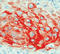 Keratin, type I cytoskeletal 17 antibody, DM127-05, Origene, Immunohistochemistry paraffin image 