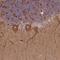 Small Nuclear Ribonucleoprotein U11/U12 Subunit 25 antibody, HPA044248, Atlas Antibodies, Immunohistochemistry paraffin image 