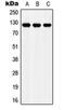 Low-density lipoprotein receptor-related protein 8 antibody, orb215224, Biorbyt, Western Blot image 