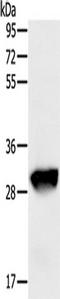 Glutathione S-Transferase Omega 1 antibody, TA350038, Origene, Western Blot image 