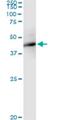 F-Box Protein 4 antibody, H00026272-M02, Novus Biologicals, Immunoprecipitation image 