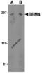 Rho guanine nucleotide exchange factor 17 antibody, 4367, ProSci Inc, Western Blot image 