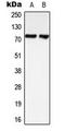 LIM domain kinase 1 antibody, LS-C354011, Lifespan Biosciences, Western Blot image 