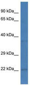 PEST Proteolytic Signal Containing Nuclear Protein antibody, TA344793, Origene, Western Blot image 