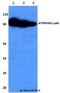 ATPase H+ Transporting V0 Subunit A2 antibody, A05969, Boster Biological Technology, Western Blot image 