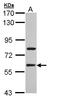 Transducin Beta Like 1 X-Linked Receptor 1 antibody, LS-C186178, Lifespan Biosciences, Western Blot image 