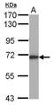 5-aminolevulinate synthase, nonspecific, mitochondrial antibody, GTX114245, GeneTex, Western Blot image 
