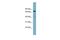 P53-Induced Death Domain Protein 1 antibody, PA5-44740, Invitrogen Antibodies, Western Blot image 