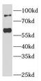 Forkhead Box P1 antibody, FNab03206, FineTest, Western Blot image 