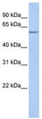 Potassium channel subfamily K member 10 antibody, TA338727, Origene, Western Blot image 