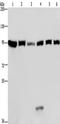 Eukaryotic Translation Elongation Factor 2 antibody, TA349920, Origene, Western Blot image 