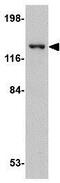 DLG Associated Protein 4 antibody, GTX85394, GeneTex, Western Blot image 