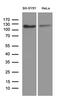 Amyloid beta A4 precursor protein-binding family B member 1 antibody, M03090, Boster Biological Technology, Western Blot image 