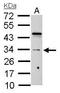 HUS1 Checkpoint Clamp Component antibody, TA308100, Origene, Western Blot image 