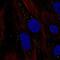 Chromosome 11 Open Reading Frame 91 antibody, NBP2-56091, Novus Biologicals, Immunofluorescence image 
