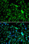 NOP2/Sun RNA Methyltransferase 6 antibody, 14-996, ProSci, Immunofluorescence image 