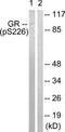 Glucocorticoid receptor antibody, TA313371, Origene, Western Blot image 