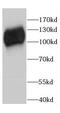 Cell Cycle Associated Protein 1 antibody, FNab01251, FineTest, Western Blot image 