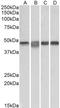 Mitogen-Activated Protein Kinase Kinase 2 antibody, TA326316, Origene, Western Blot image 