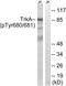 Neurotrophic Receptor Tyrosine Kinase 1 antibody, LS-C199682, Lifespan Biosciences, Western Blot image 