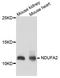 NADH:Ubiquinone Oxidoreductase Subunit A2 antibody, orb373970, Biorbyt, Western Blot image 