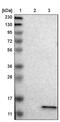 Vacuolar ATPase Assembly Factor VMA21 antibody, PA5-52766, Invitrogen Antibodies, Western Blot image 