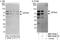Zinc Finger And BTB Domain Containing 44 antibody, NBP1-78184, Novus Biologicals, Western Blot image 