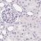 Synaptoporin antibody, NBP2-13405, Novus Biologicals, Immunohistochemistry paraffin image 