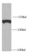 Rho Associated Coiled-Coil Containing Protein Kinase 1 antibody, FNab07376, FineTest, Western Blot image 