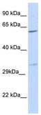 Phosphoribosyl Pyrophosphate Synthetase 2 antibody, TA346064, Origene, Western Blot image 