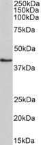 Hydroxymethylbilane Synthase antibody, STJ73153, St John