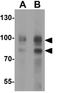 Neuroligin-2 antibody, GTX31597, GeneTex, Western Blot image 