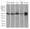 Thioredoxin Reductase 1 antibody, LS-C795924, Lifespan Biosciences, Western Blot image 