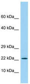 Prostate And Breast Cancer Overexpressed 1 antibody, TA331281, Origene, Western Blot image 